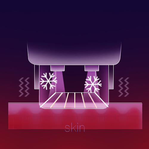 Thermage FLX